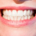 Śliczne urodziwe zęby również efektowny prześliczny uśmiech to powód do dumy.